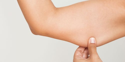 Winkearme wegtrainieren - Übungen für straffe Oberarme